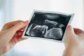 Grávidas vão poder pesquisar obstetras competentes em ecografias