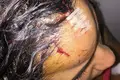 PSP acusada de agredir mulher na cabeça