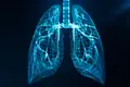 Saúde. IA vai ajudar a detetar cancro do pulmão