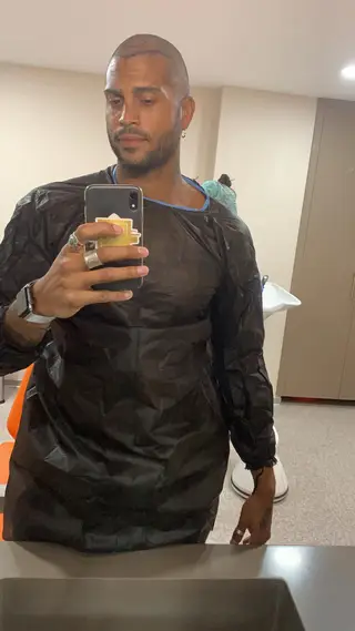 Guillaume Lalung teve de rapar o cabelo antes de fazer o transplante