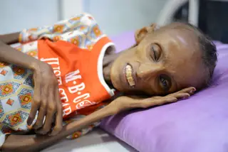 Saida Ahmad Baghili, 18 anos. Recebe tratamento num hospital no Iémen para a subnutrição.