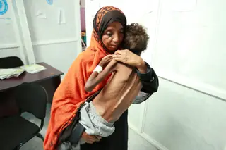 Uma mãe carrega o filho de 8 anos, malnutrido, num hospital no Iémen.