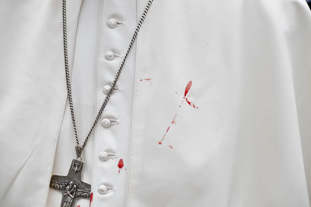 Setembro - O Papa sofreu um pequeno golpe na cara, ao cortar-se no vidro do papamóvel quando saudava uma criança, durante um percurso pelo bairro de San Francisco, em Cartagena, Colômbia.