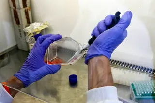 Uma equipa do Hospital Mount Sinai, em Nova Iorque, concluiu que a medicação usada para diluir a espessura do sangue pode salvar alguns dos pacientes mais afectados pela Covid-19.