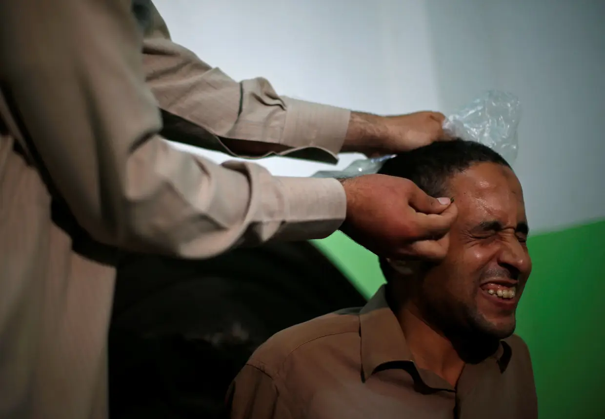 Um paciente recorre a uma terapia alternativa que envolve picadas de abelha no Cairo, Egito.