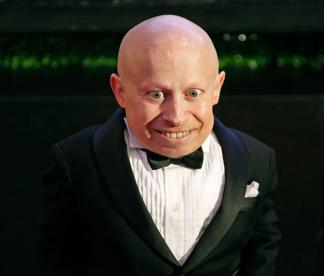 O ator norte-americano Verne Troyer, conhecido sobretudo por ter interpretado Mini Me nos filmes da série "Austin Powers", morreu aos 49 anos. (1 de janeiro de 1969 - 21 de abril de 2018)
