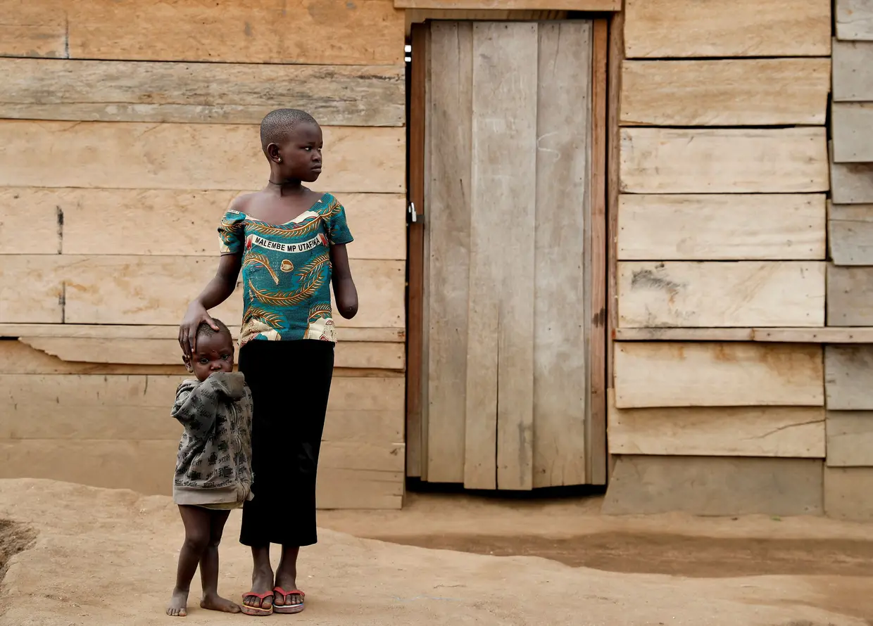 Mave Grace, uma menina de 11 anos que viu o braço ser cortado, num ataque à sua vila, Tchee, e a irmã, também vítima do ataque por parte de milícias, na República Democrática do Congo.
