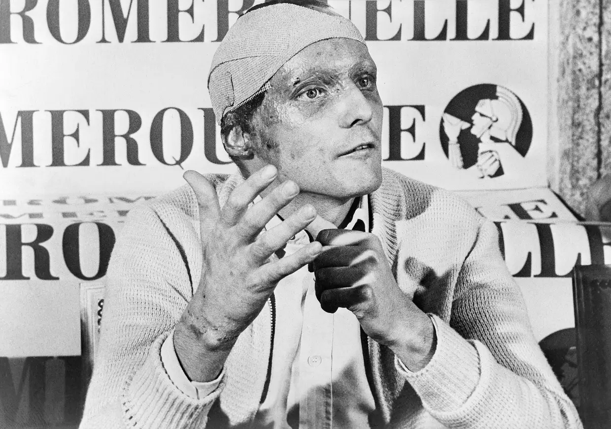 Niki Lauda teve de ser sujeito a dois transplantes de rim, em 1997 e 2005, após o acidente de Nuremberga, na Alemanha.
