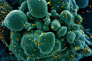 Atingir o pico da pandemia é bom ou mau?