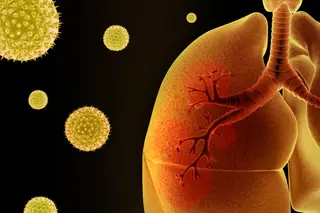 Viver com asma numa pandemia: o mundo ficou alerta, os asmáticos em dose extra