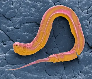 Caenorhabditis elegans