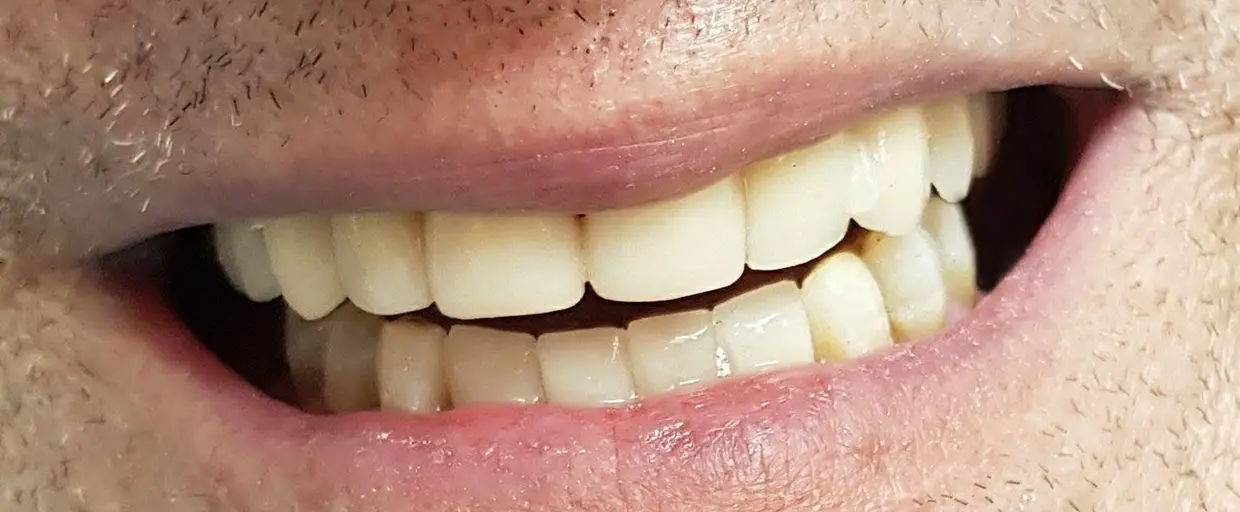 O resultado final do trabalho dos profissionais da Clínica Milénio.