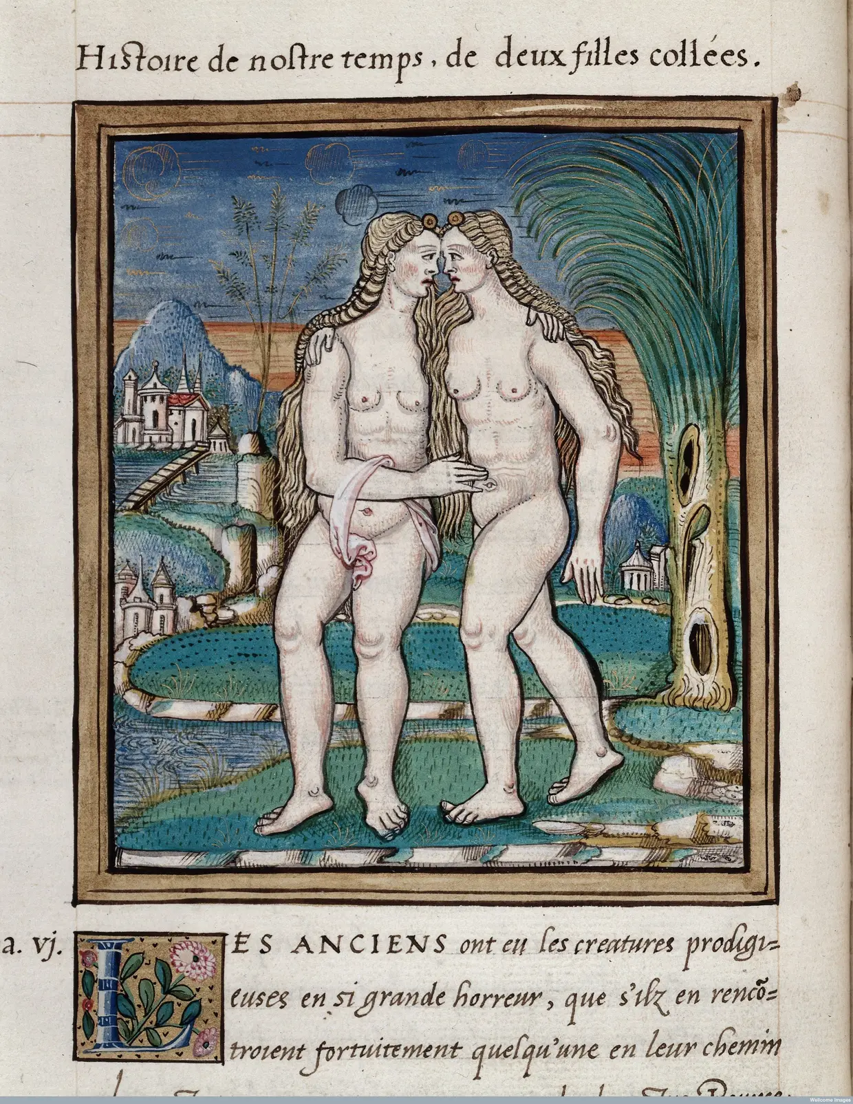 Duas jovens com corpos ligados, ilustração revelada em Histoires Prodigieuses (1560) de Pierre Boaistuau