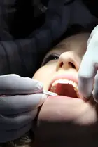 9 causas da periodontite e como evitar uma doença que pode levar à remoção dos dentes