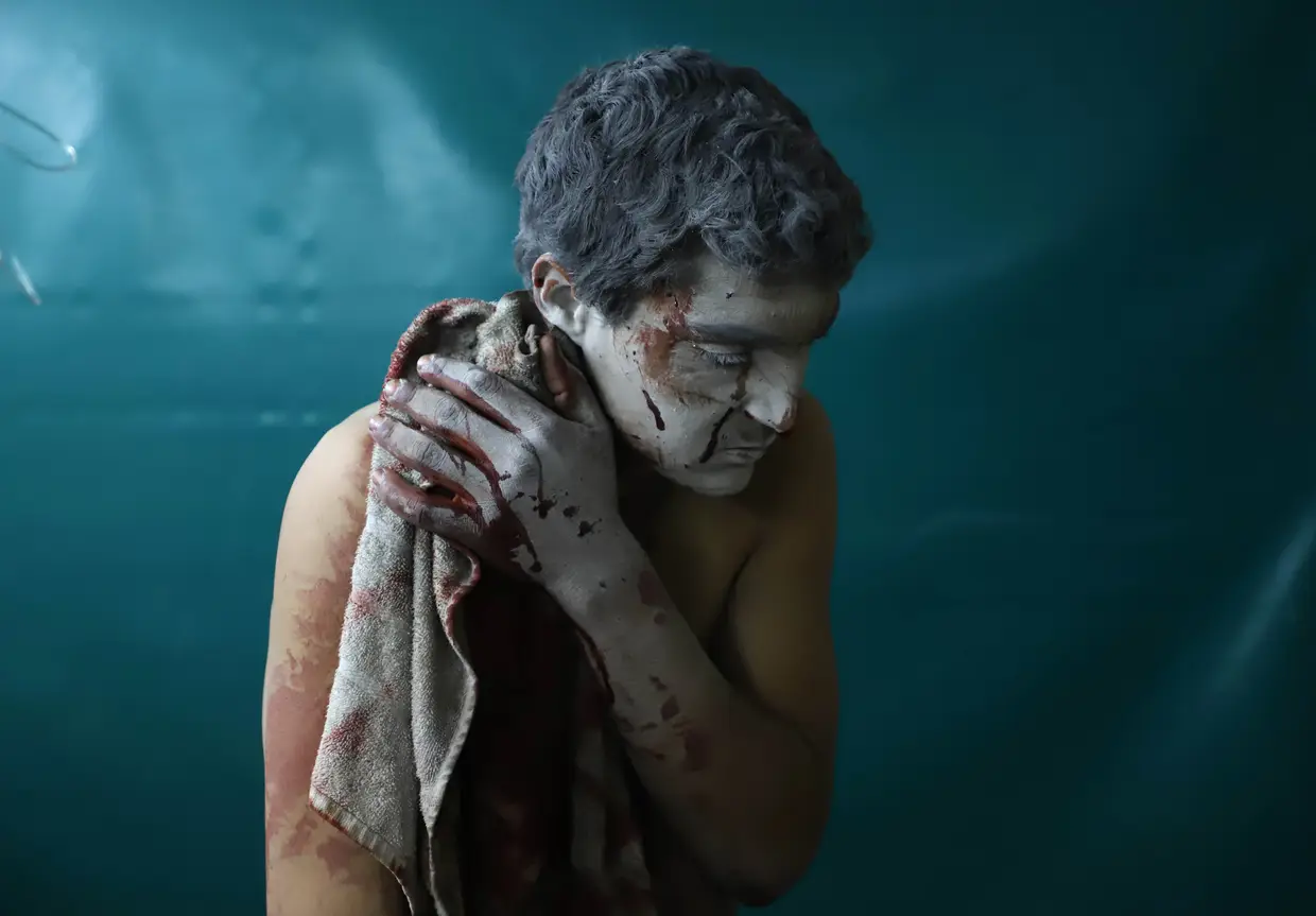 Um homem sírio ferido aguarda tratamento numa clínica improvisada durante ataques aéreos do governo sírio em Zamalka, no enclave rebelde de Ghouta Oriental, nos arredores de Damasco, em 13 de março de 2018