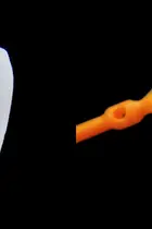 O essencial sobre facetas dentárias