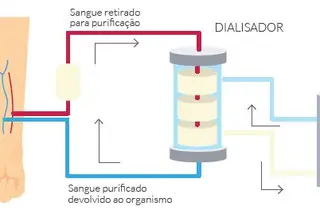 Tem problemas no sistema renal. Como tratar?