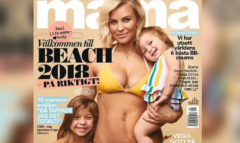 como acabar com a barriga flacida apos a gravidez