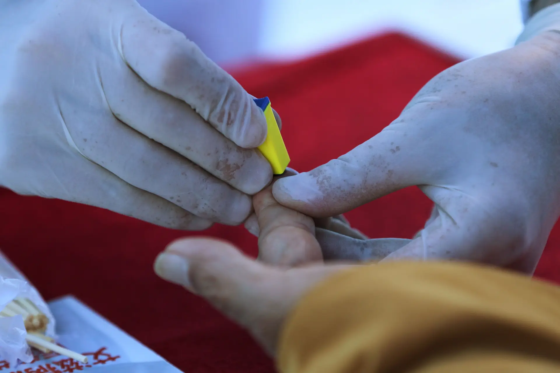 Covid-19: diminuição de rastreios de VIH pode aumentar infeções por décadas