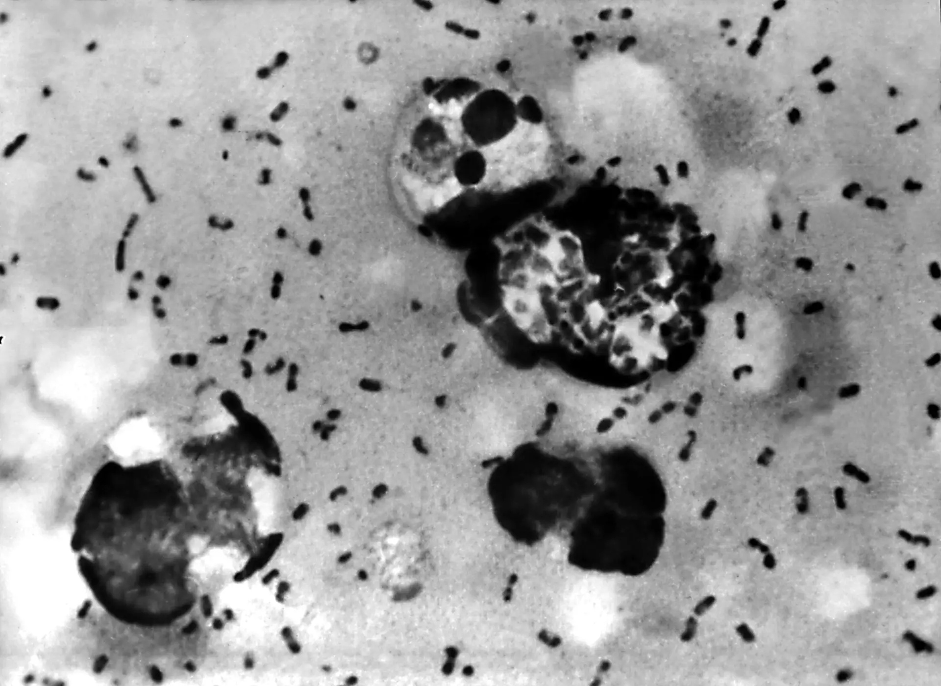 Dois casos de peste detetados na China