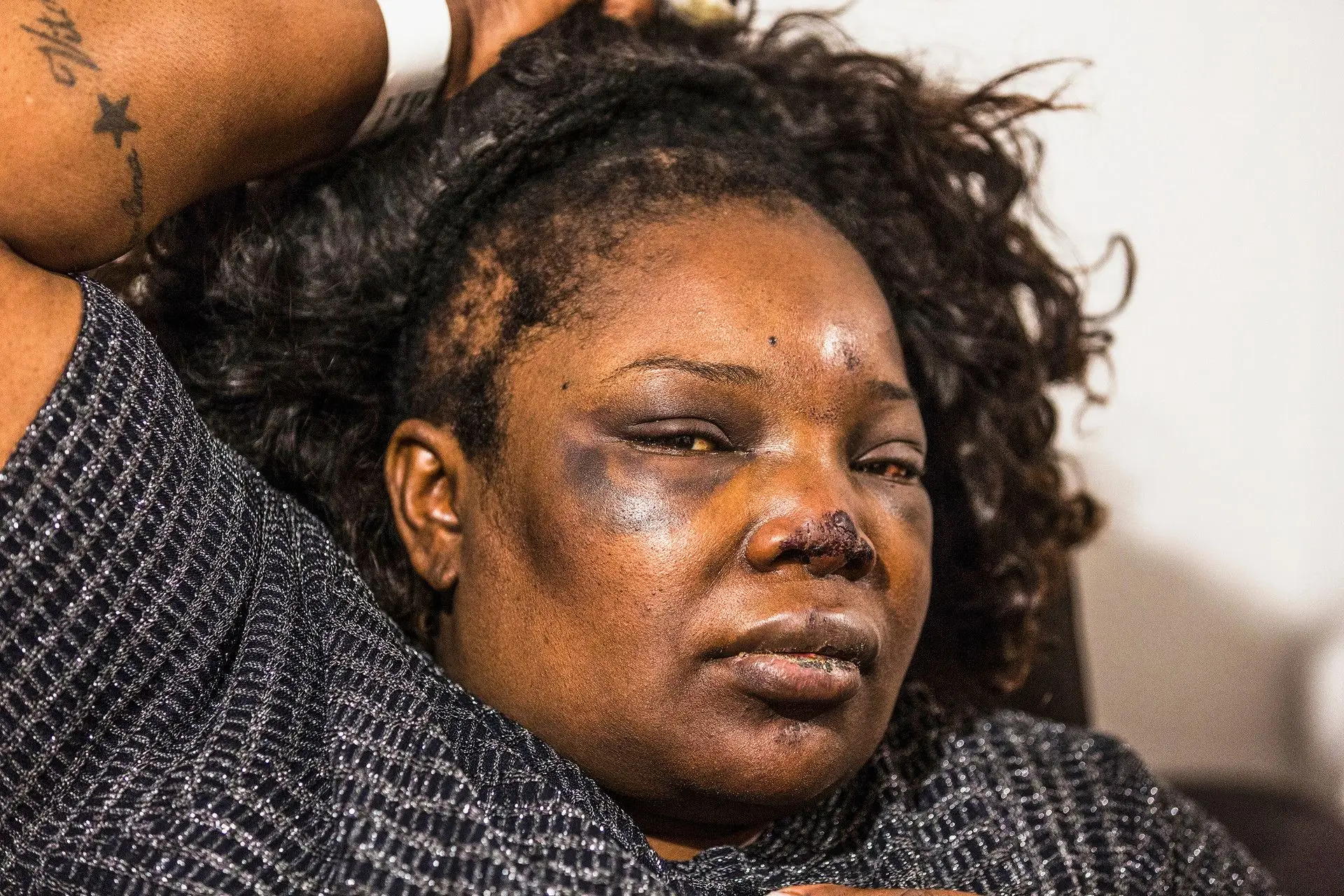 Cláudia Simões, 42 anos, acusou agente da PSP da Amadora de violência policial