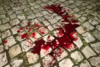 Imagens chocantes do motorista agredido