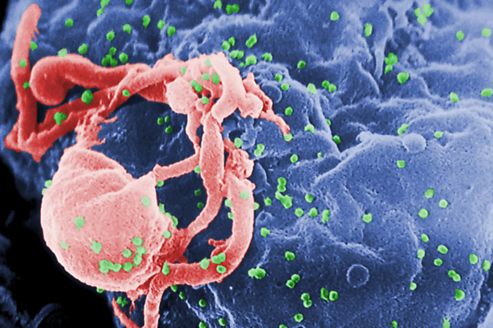 Meta para acabar com a Sida até 2030 está ameaçada devido à pandemia do novo coronavírus