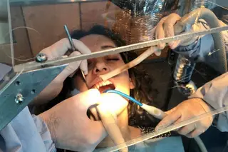 Covid-19. É português o escudo protetor de aerossóis para medicina dentária