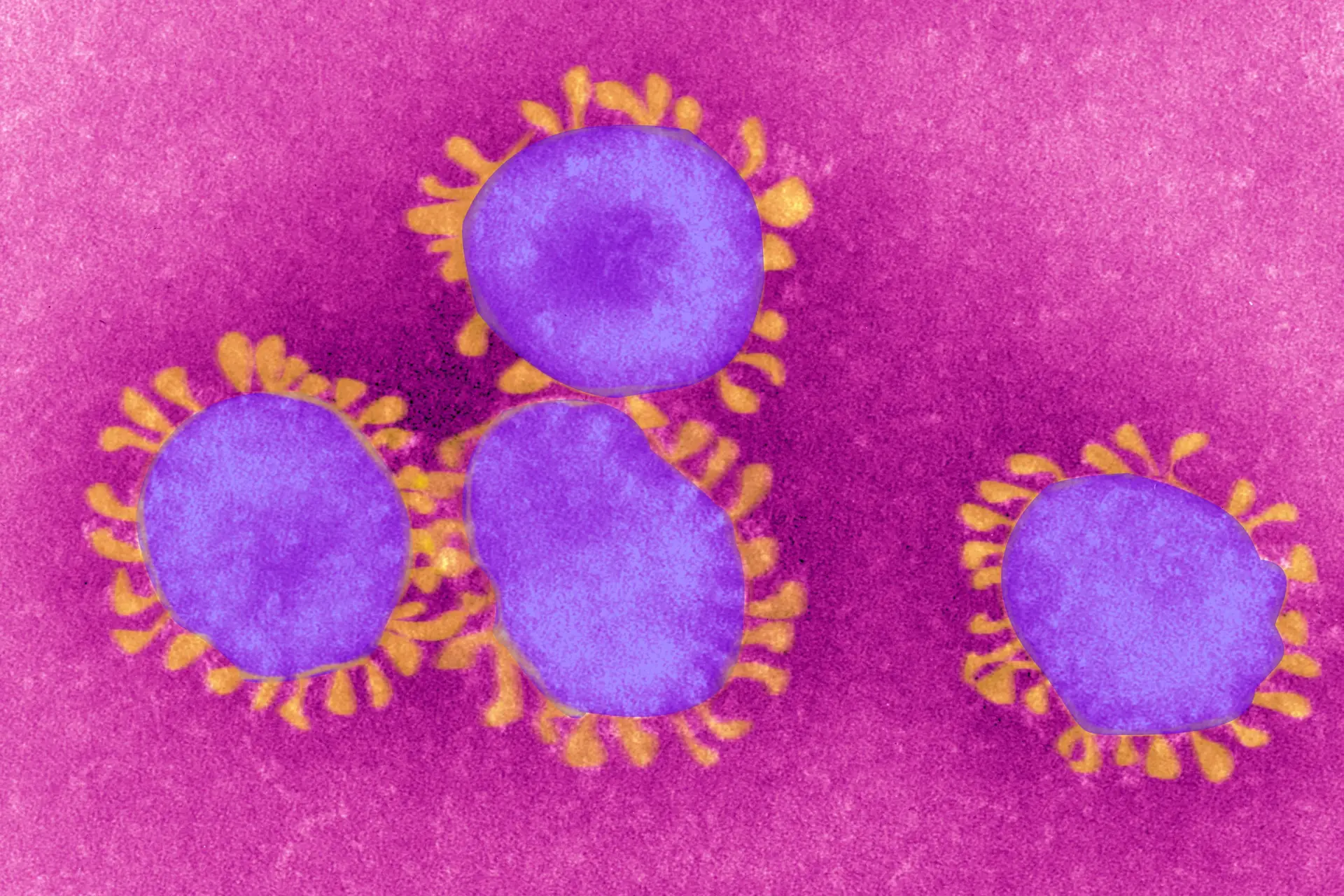 A pandemia vai provocar “evoluções futuras” nos seguros