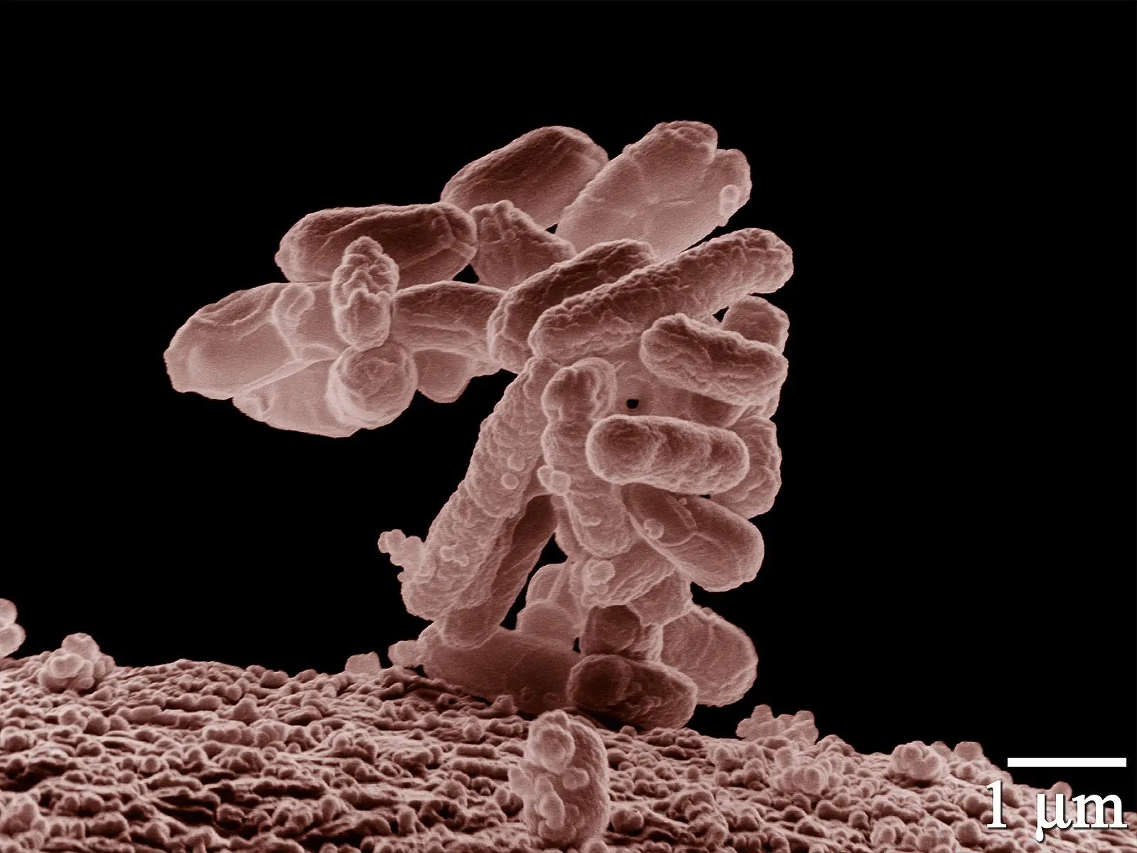 Escherichia coli (mais conhecida por e-coli) é uma das bactérias que têm vindo a revelar capacidade de resistência aos antibióticos