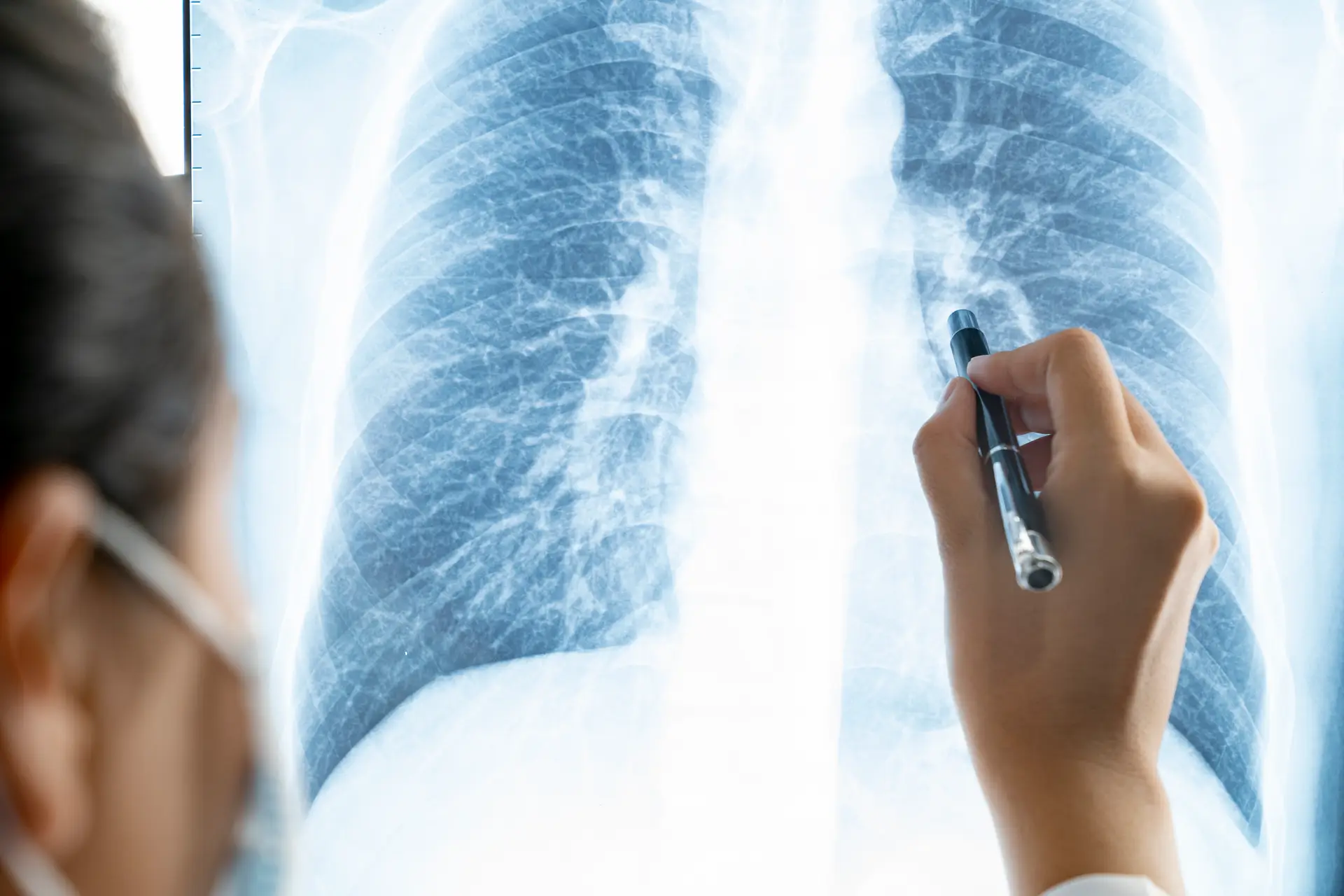 Mais de 70% dos portugueses nunca ouviu falar em Doença Pulmonar Obstrutiva Crónica
