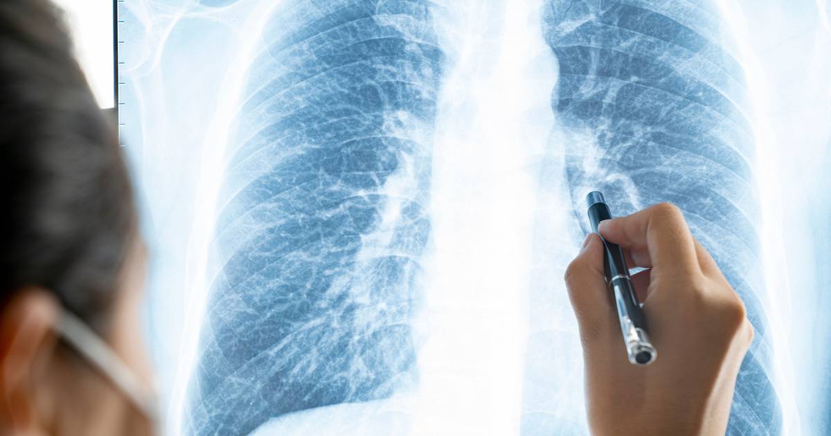 É a terceira causa de morte no mundo mas ainda pouco conhecida entre os portugueses: o que é a DPOC?