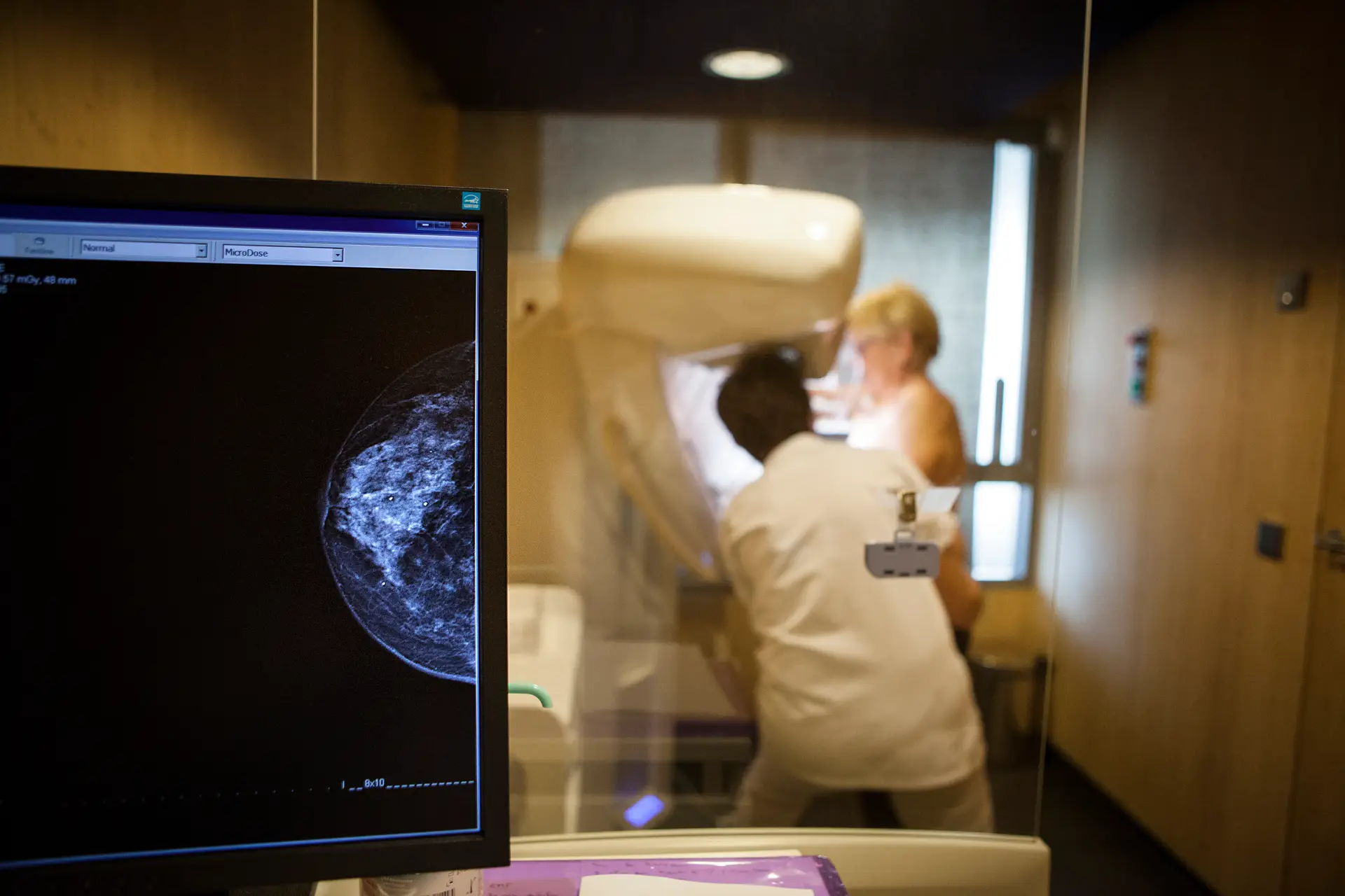 Cancro da mama com menor taxa de sobrevivência nas mulheres idosas: a razão pode ser falta de tratamento, avança estudo