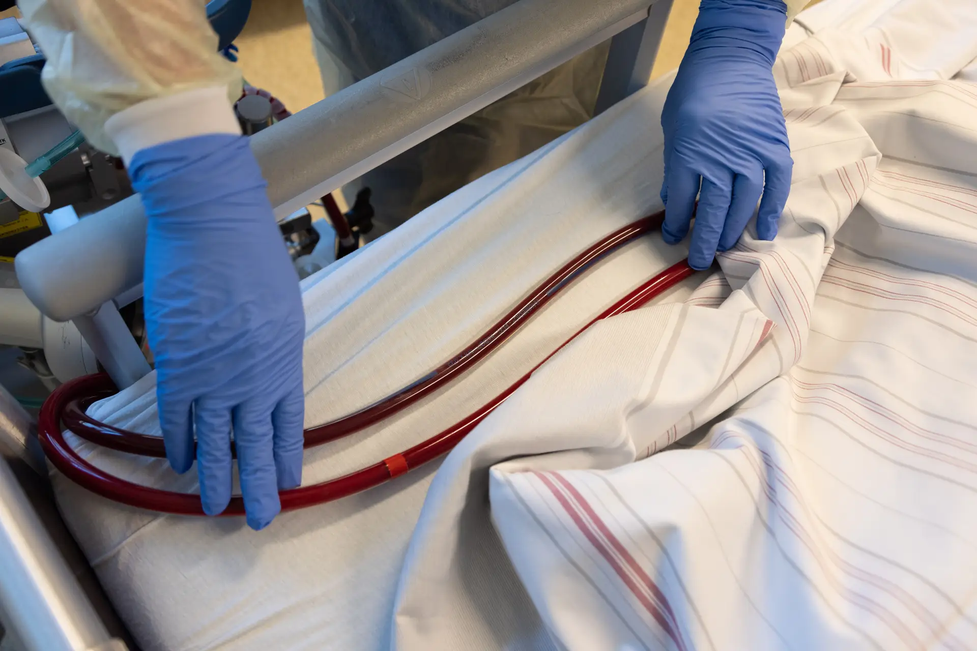 Hospital de Madrid fez transplante inédito em bebé, com o intestino de um dador morto