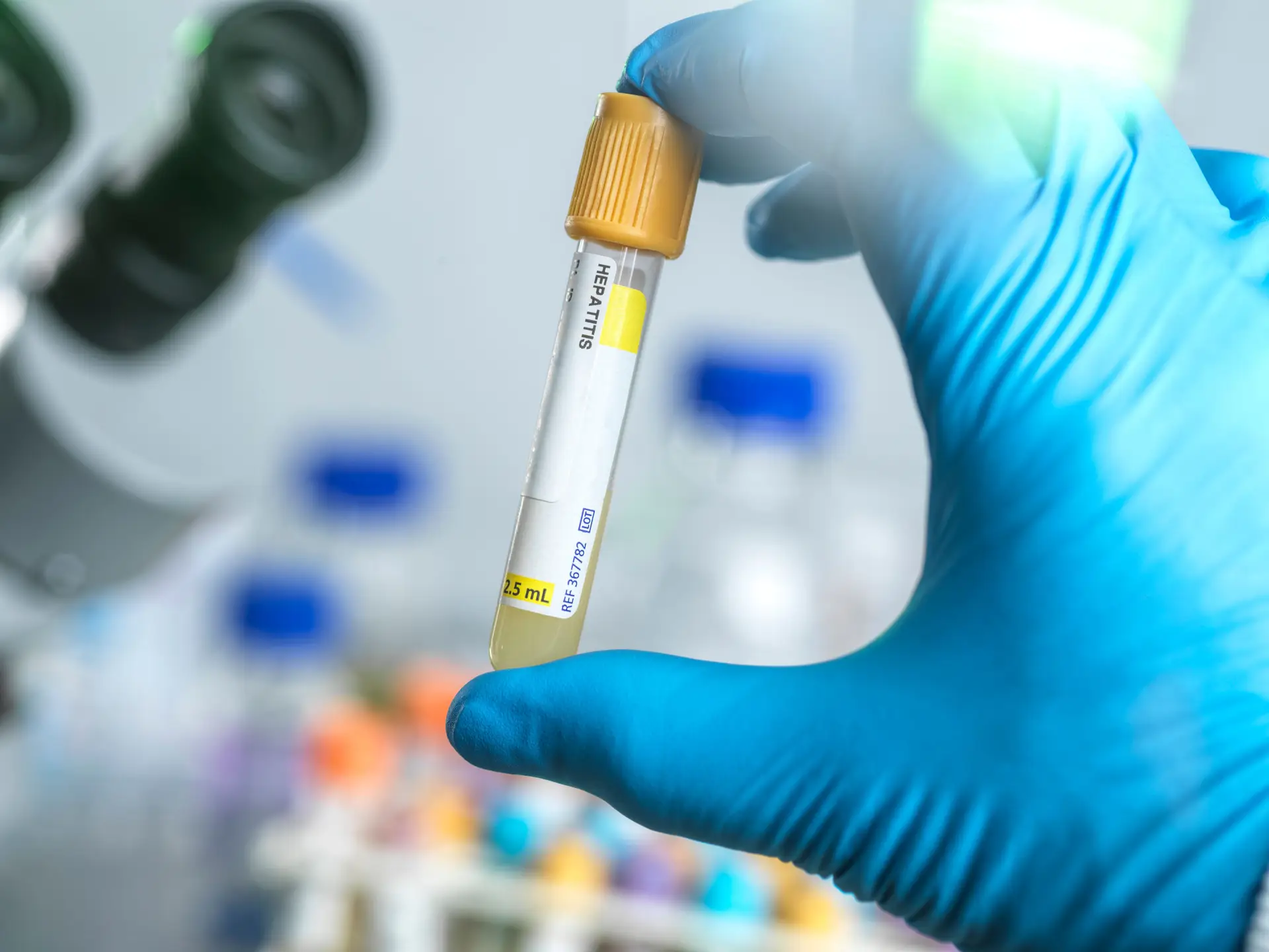 Tratamentos da hepatite C iniciados em 2020 e 2021 caíram mais de 40%