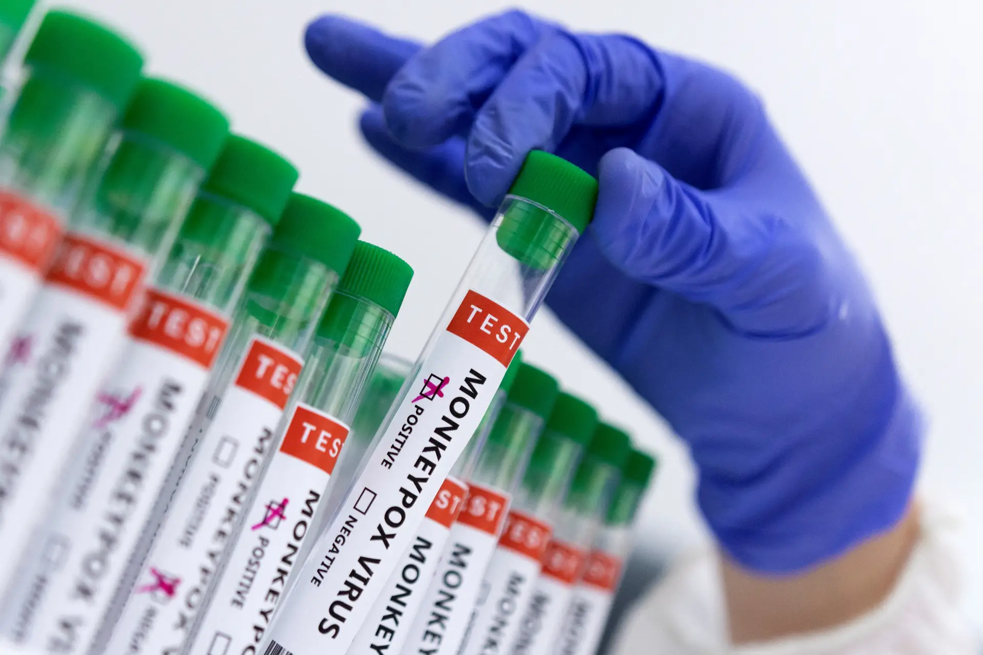 Monkeypox: DGS autoriza dose reduzida para vacinação preventiva