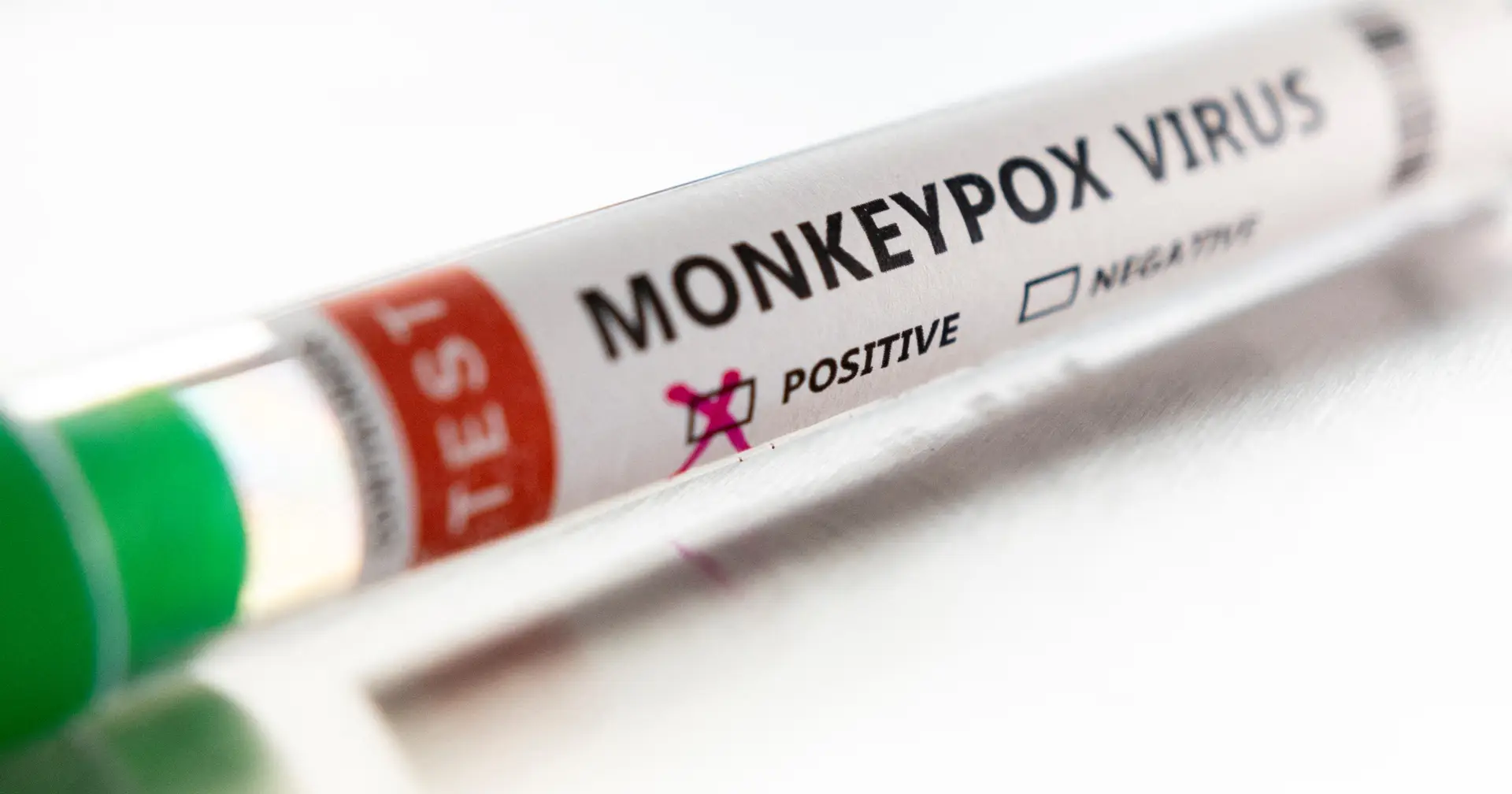 Monkeypox: “Não está disponível um grande número de vacinas para comprar”
