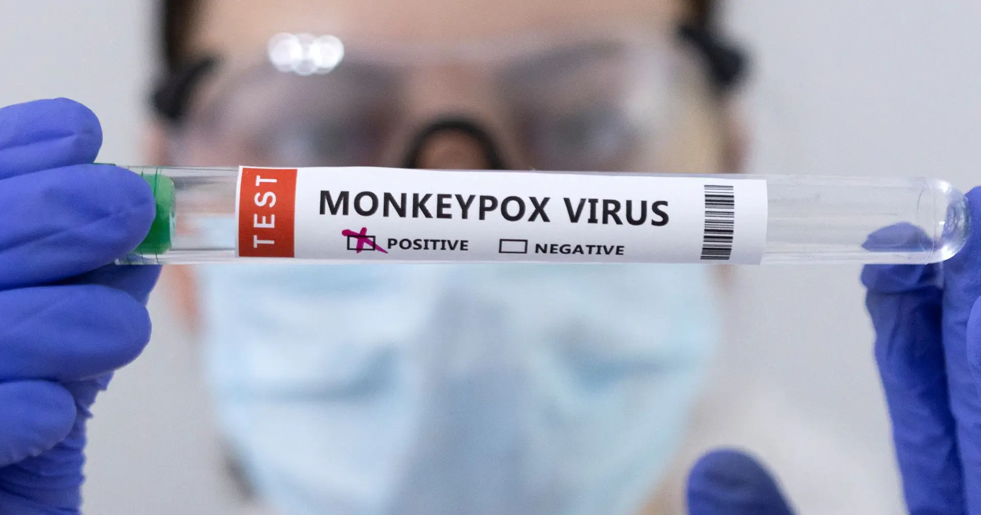 Affenpocken: Brüssel fordert „verstärkte und konzertierte Maßnahmen“ in der EU, um den Ausbruch zu kontrollieren