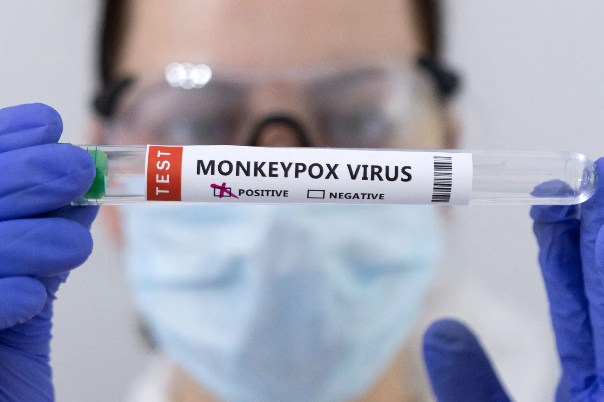 Monkeypox: número de infeções em Portugal sobe para 846