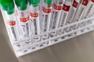 DGS admite vacina contra a Monkeypox para conter cadeias de transmissão