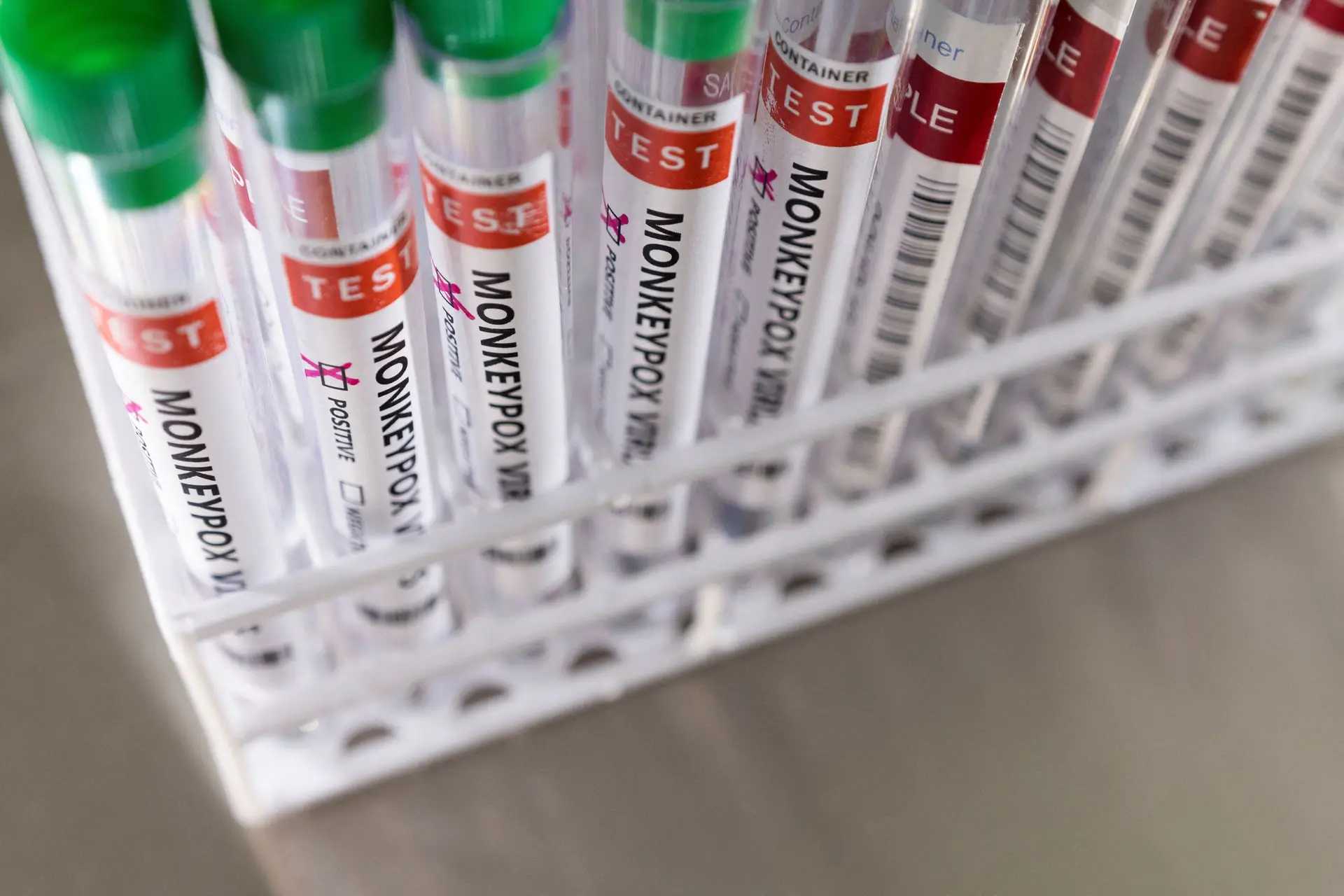 Monkeypox. Número de infeções em Portugal sobe para 770