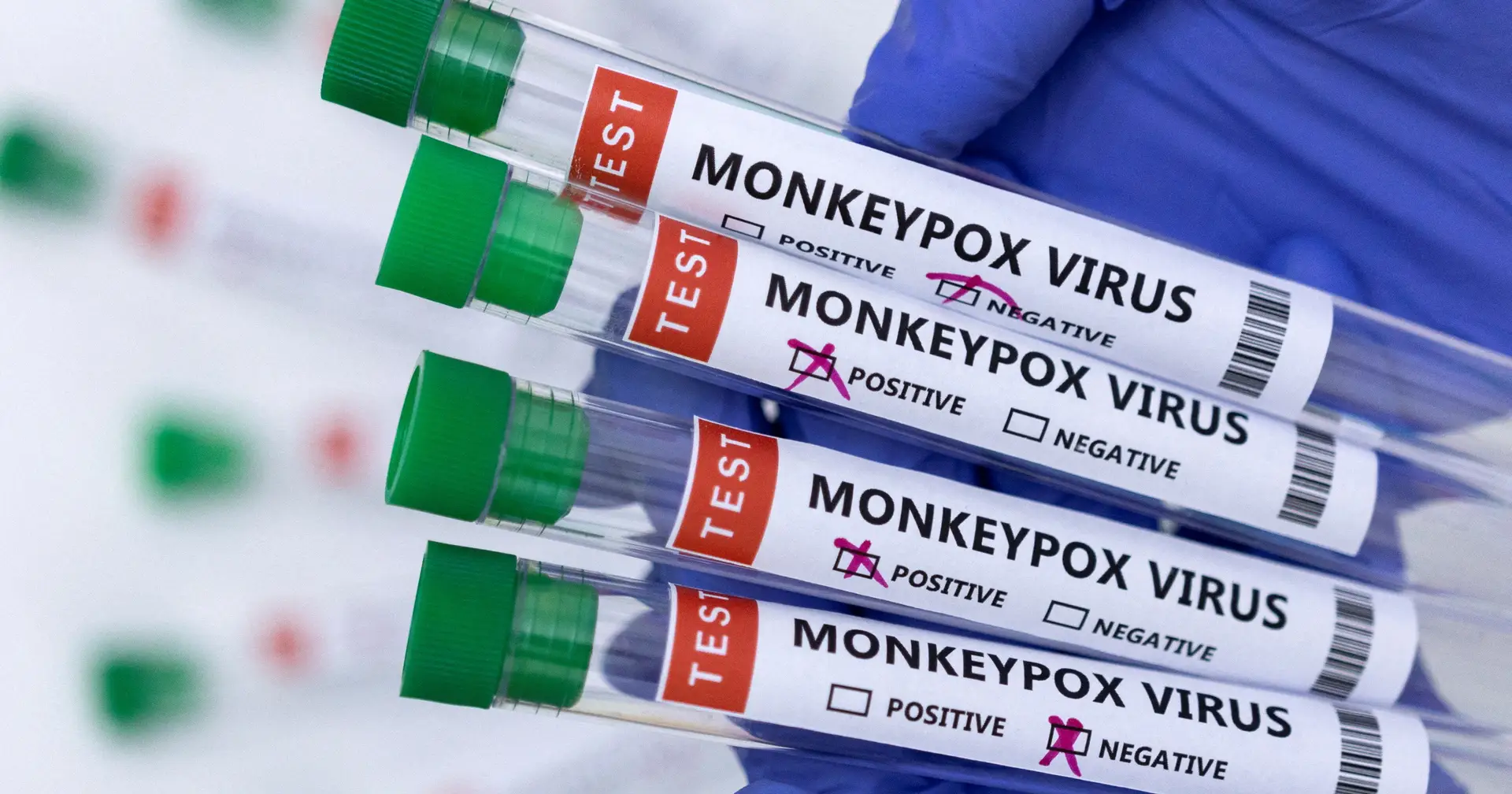 Monkeypox: Espanha recebe primeiras doses de vacinas, Portugal segue-se em breve