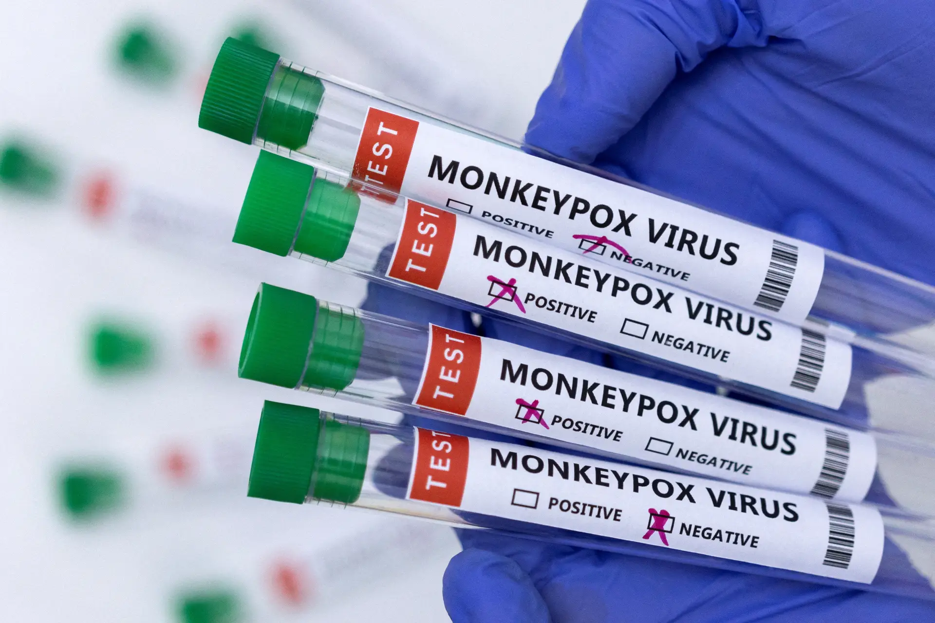 Monkeypox: 1190 pessoas vacinadas e 948 casos confirmados em Portugal