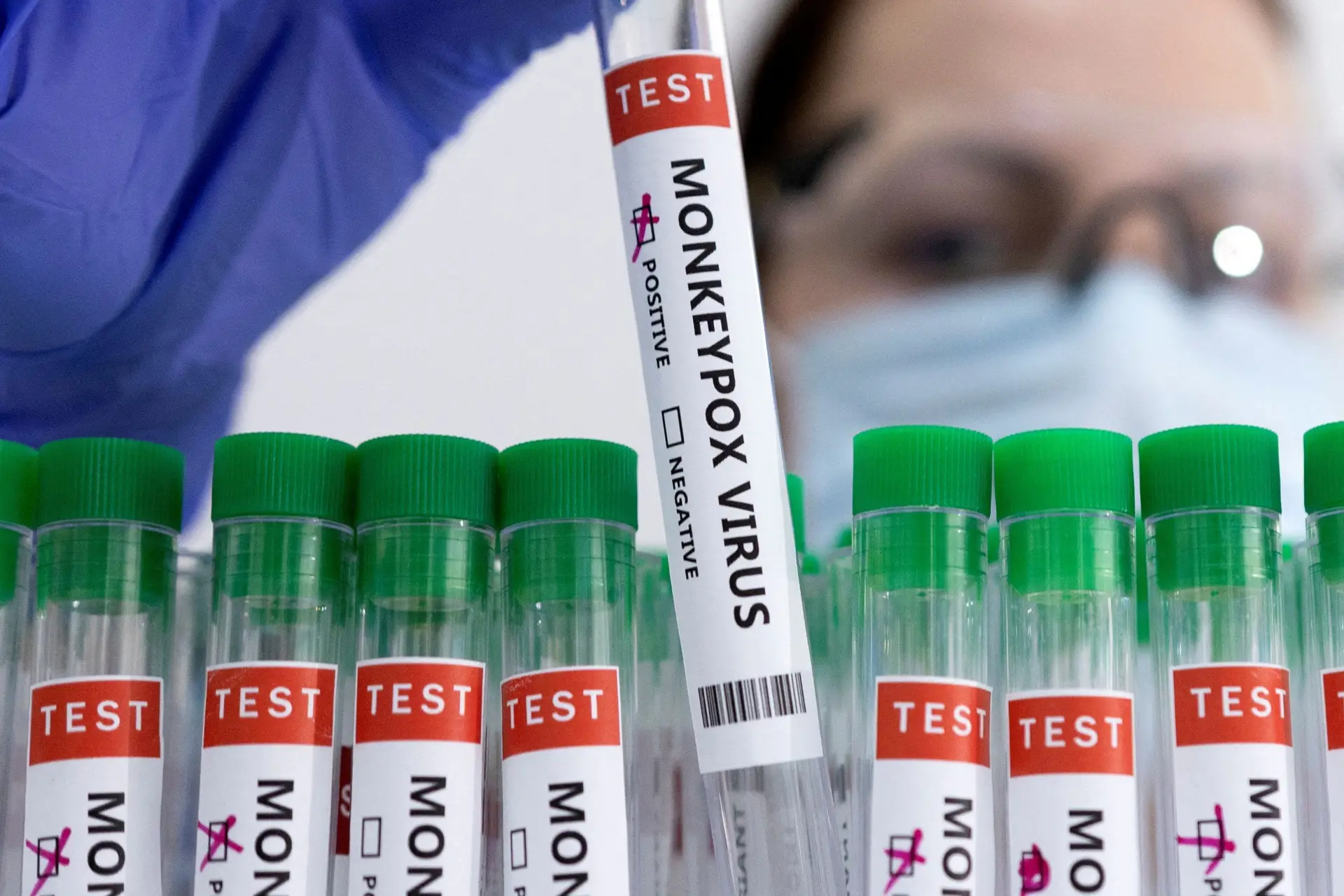 Monkeypox: EMA autoriza nova técnica de injeção da vacina para cobrir mais pessoas