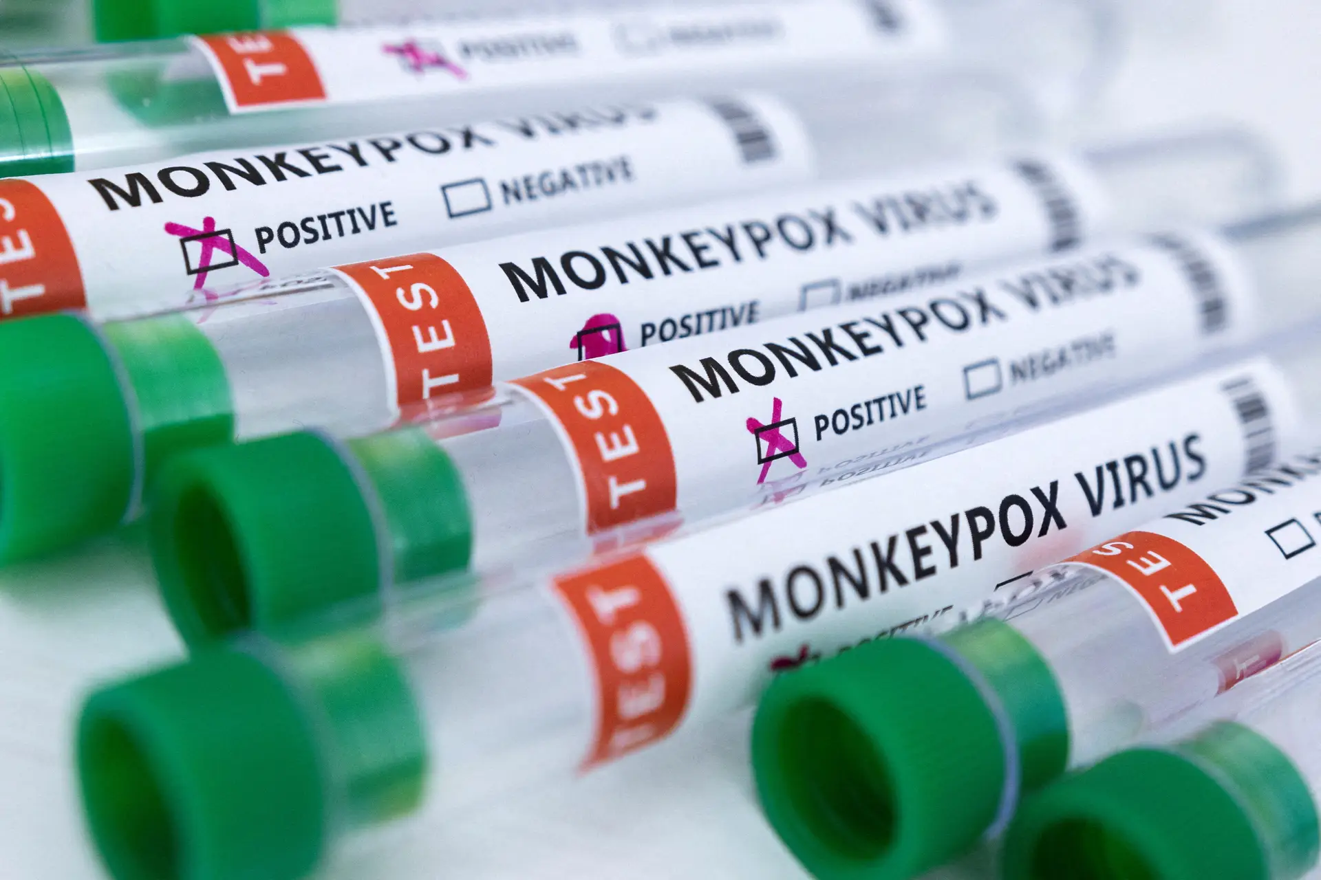 Monkeypox: surto em aparente fase de abrandamento em Portugal