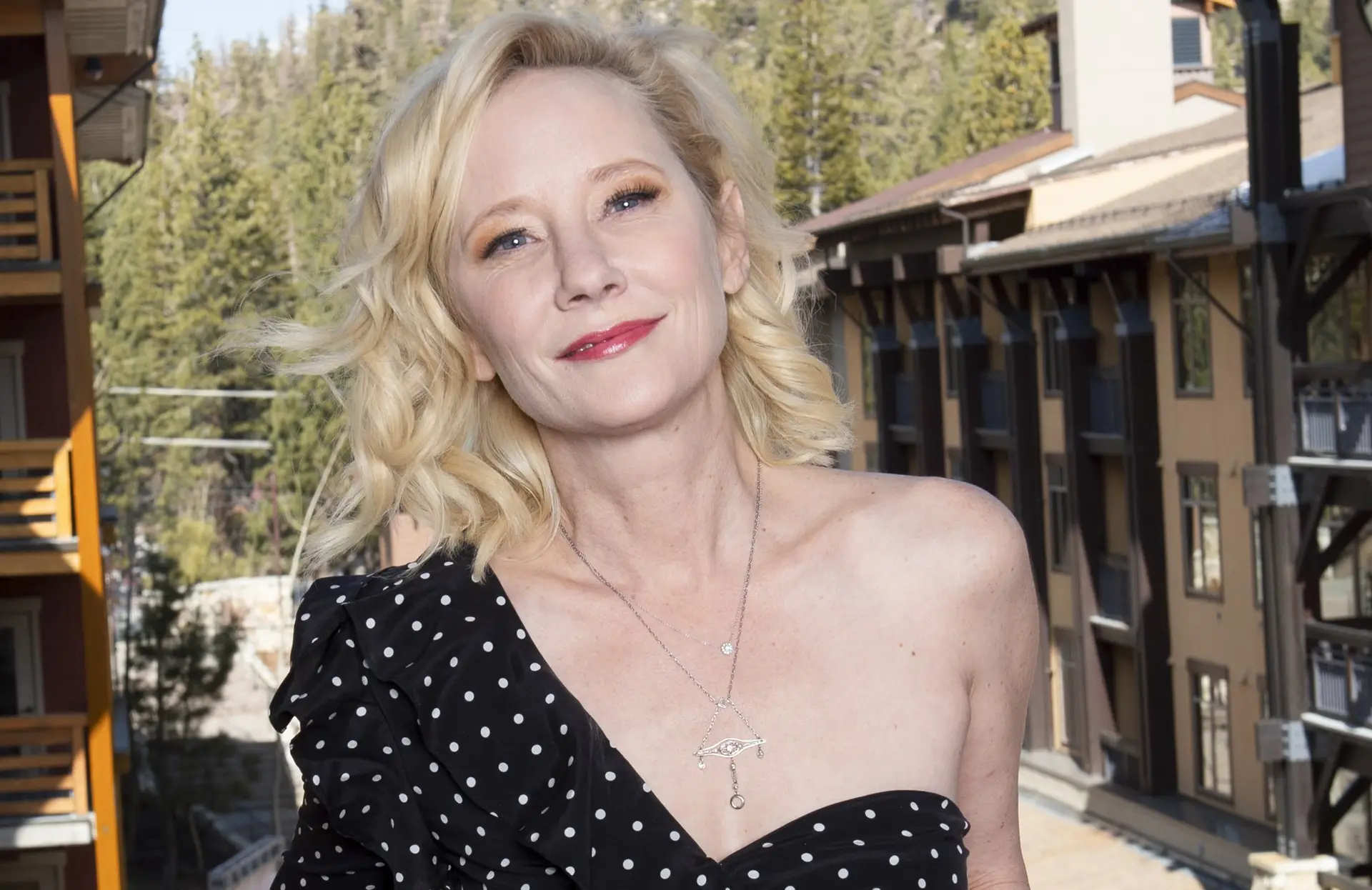 Estado de saúde de Anne Heche é “estável” mas a atriz apresenta “queimaduras graves”