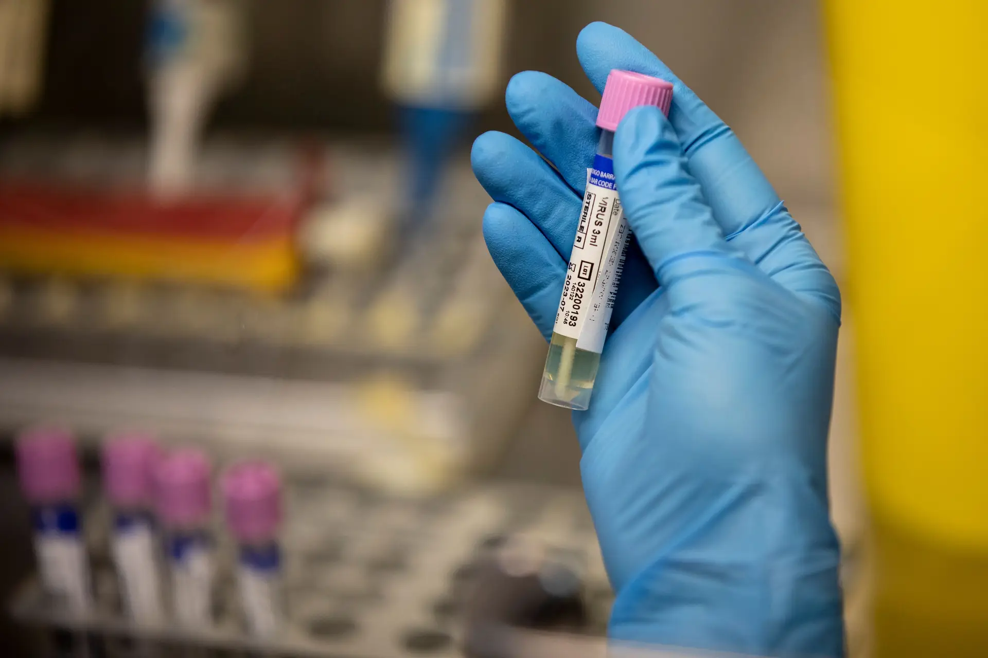 Monkeypox: Portugal com 944 casos e mais de 800 pessoas vacinadas