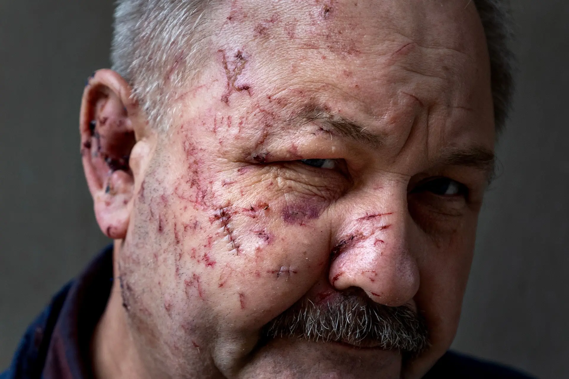 Cicatrizes profundas, valas comuns, corpos sem vida: fotojornalista do Expresso premiado pelo trabalho na Ucrânia