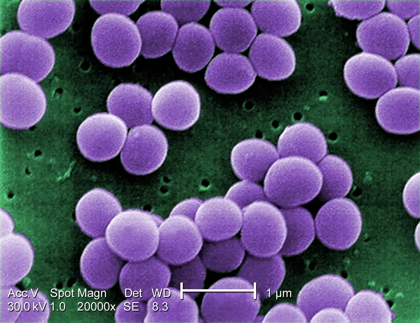 Imagem de microscópio da superbactéria Staphylococcus aureus