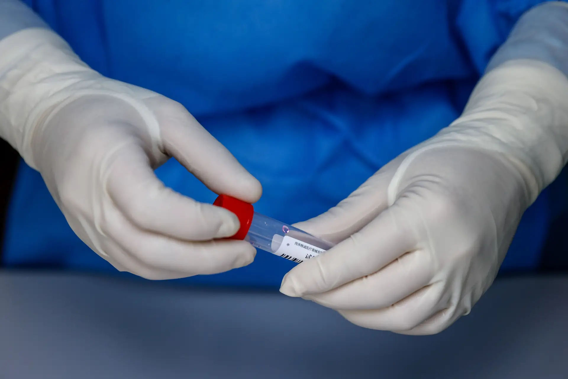 Estudo espanhol aponta que idade avançada é o principal fator de mortalidade por covid-19